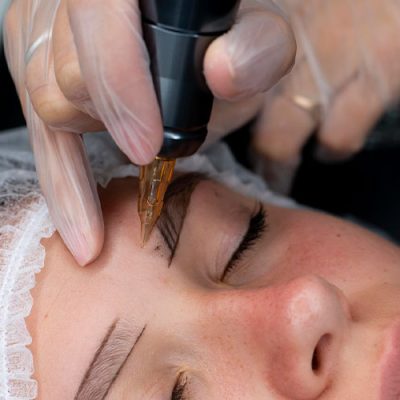 درمان تاتو ابرو