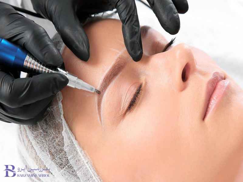 جلوگیری از تغییر رنگ ناخواسته در فیبروز ابرو