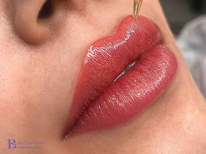 جلوگیری از خشکی و پوسته‌ریزی لب