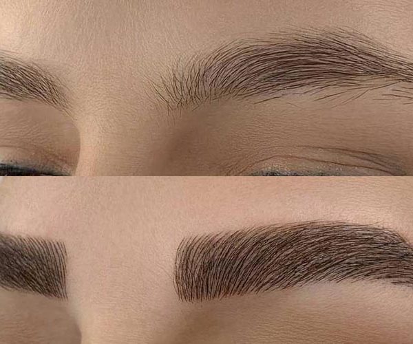 چه کسانی نباید میکروبلیدینگ انجام دهند ؟