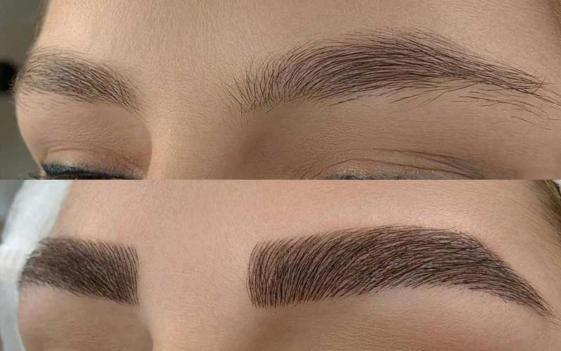 چه کسانی نباید میکروبلیدینگ انجام دهند ؟
