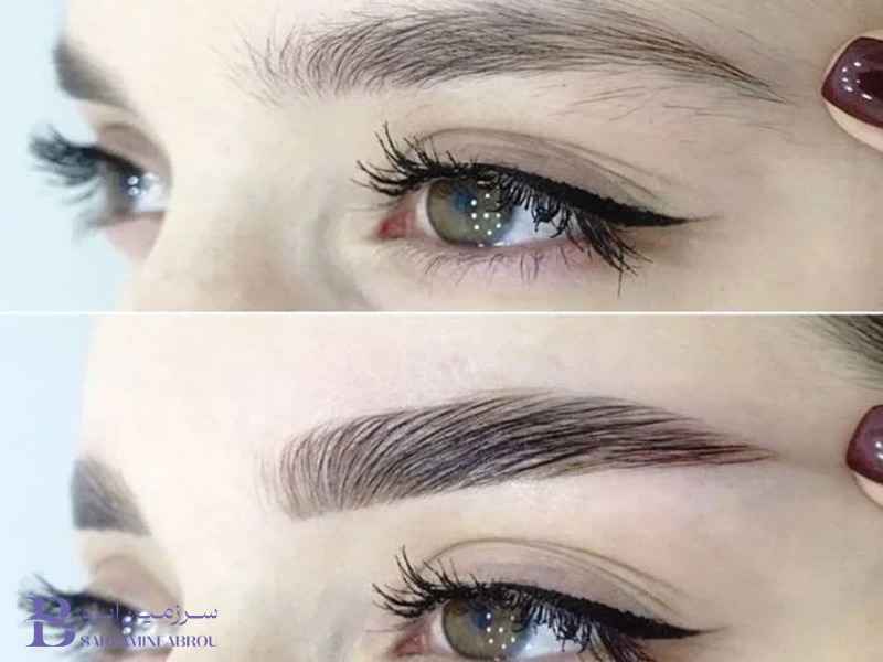 هزینه فیبروز ابرو دخترانه