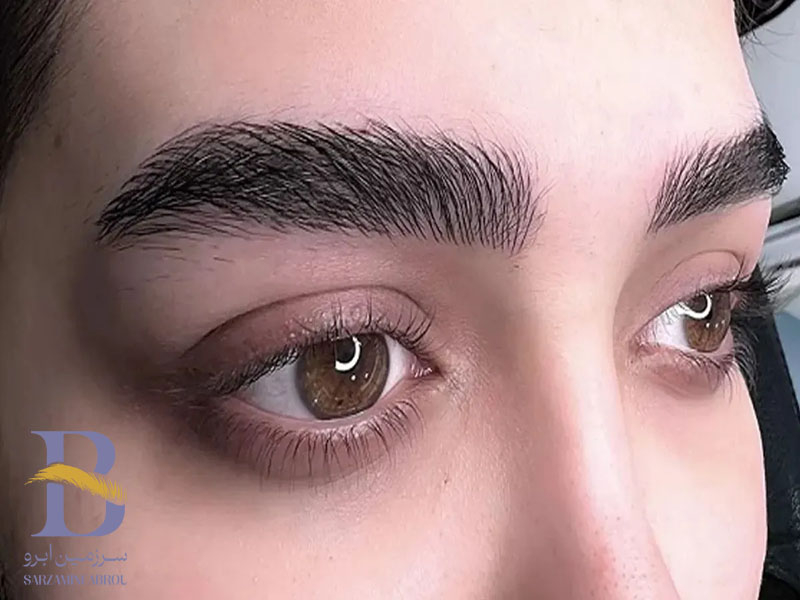 ماندگاری و برنامه ترمیم در فیبروز و میکروبلیدینگ ابرو